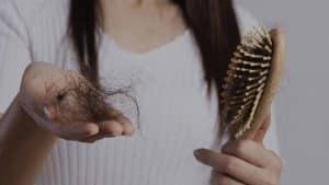 caida de pelo postparto