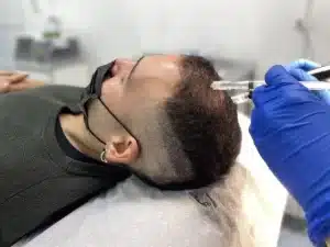 Mesoterapia capilar