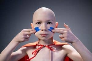 ALOPECIA INFANTIL