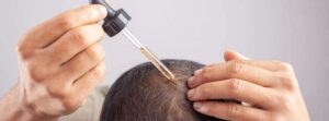 minoxidil
