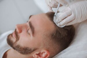 infiltraciones de plasma cabello